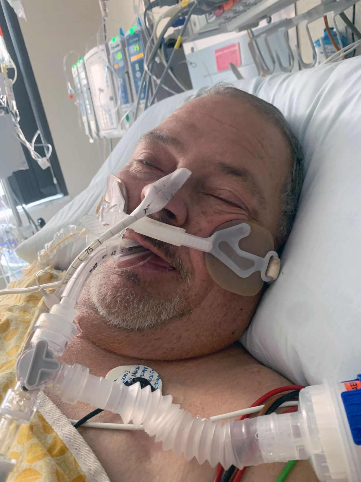 Michael Munday, a patient at UofL Health - Jewish Hospital who received Kentucky's first double-transplant of a heart and liver
